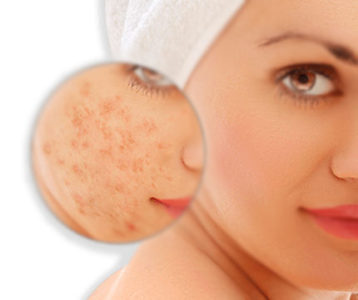 How Should Take Care My Skin before Sleeping