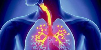 Symptoms of Acute Bronchitis